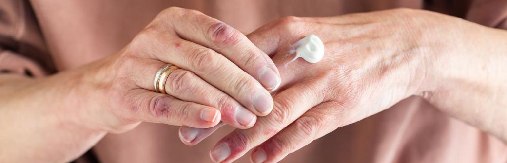 Więcej niż uczulenie. Atopowe zapalenie skóry i alergia pokarmowa 