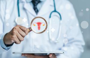 Zespół policystycznych jajników - objawy, diagnoza, dieta
