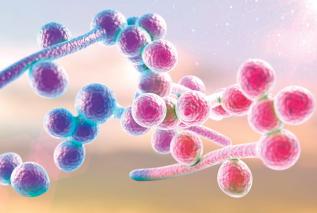Kandydoza - przyczyny, objawy i sposoby leczenia
