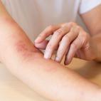 Zamień pączka na ciepły posiłek dla Dziecka – Fundacja POCIECHA po raz szósty wspiera niedożywione dzieci