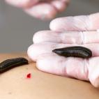 Rodzaje nieodczynności tarczycy - przyczyny i objawy