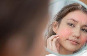 Rumień na twarzy - jak powstaje i jak sobie z nim radzić naturalnymi sposobami?